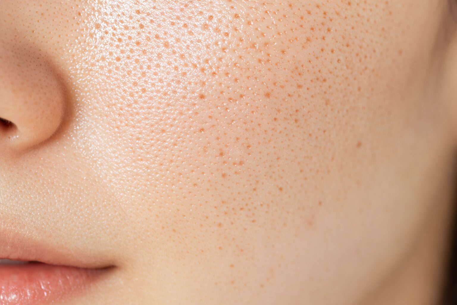 모공이 넓어지는 이유